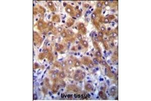 ABCB10 antibody (N-term) (ABIN652180 and ABIN2840585) immunohistochemistry analysis in formalin fixed and paraffin embedded human liver tissue followed by peroxidase conjugation of the secondary antibody and DAB staining.