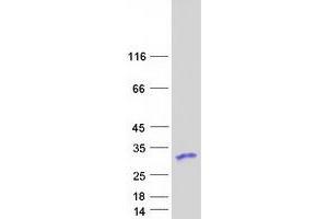 Validation with Western Blot