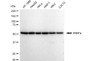 Western blotting analysis using PRPF4 antibody (ABIN7800057).