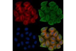 Phospho-Beclin 1 (Ser234) Antibody staining Hela cells(45 min of heat-shock treatment) by IF/ICC.