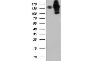 HEK293T cells were transfected with the pCMV6-ENTRY control (Left lane) or pCMV6-ENTRY HDAC6 (Right lane) cDNA for 48 hrs and lysed. (HDAC6 anticorps)