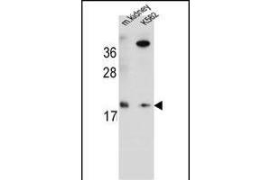 R Antibody (Center) (ABIN654772 and ABIN2844451) western blot analysis in mouse kidney tissue and K562 cell line lysates (35 μg/lane). (RNF185 anticorps  (AA 88-117))