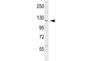ABL1 antibody western blot analysis in MCF-7 lysate.