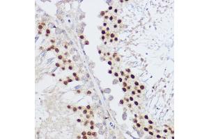 Immunohistochemistry of paraffin-embedded rat testis using KLF12 antibody (ABIN7268152) at dilution of 1:100 (40x lens). (KLF12 anticorps)