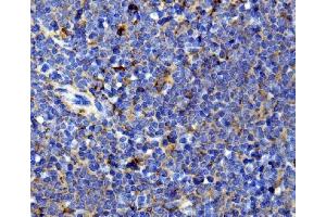 IHC analysis of Il13 using anti-Il13 antibody (ABIN7600672). (IL-13 anticorps  (AA 22-131))