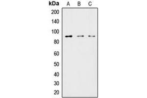 Western blot analysis of HSL expression in HeLa (A), MCF7 (B), COLO205 (C) whole cell lysates.