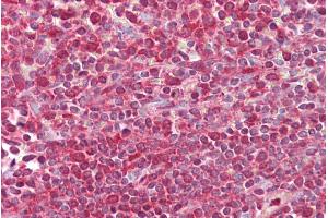 Immunohistochemistry with Spleen tissue at an antibody concentration of 5µg/ml using anti-EGR3 antibody (ARP38462_P050)