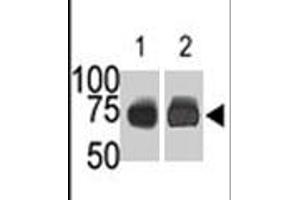 The SPHK2 polyclonal antibody  is used in Western blot (Lane 1) to detect c-myc-tagged SPHK2 in transfected 293 cell lysate (ac-myc antibody is used as control in Lane 2) . (SPHK2 anticorps  (N-Term))