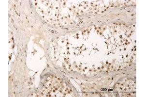 Image no. 1 for anti-Zinc Finger Protein 213 (ZNF213) (AA 133-243) antibody (ABIN599017) (ZNF213 anticorps  (AA 133-243))