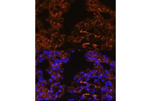 Immunofluorescence analysis of Rat lung cells using Caveolin-1 antibody (ABIN6131271, ABIN6137992, ABIN6137993 and ABIN6218615) at dilution of 1:100.