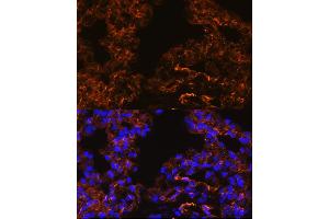 Immunofluorescence analysis of Rat lung cells using Caveolin-1 antibody (ABIN6131271, ABIN6137992, ABIN6137993 and ABIN6218615) at dilution of 1:100. (Caveolin-1 anticorps  (AA 1-100))