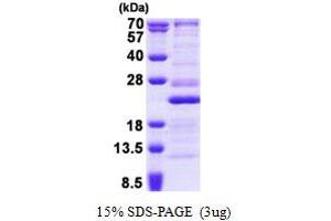 SDS-PAGE (SDS) image for Ribosomal Protein L26 (RPL26) (AA 1-145) protein (His tag) (ABIN5853064) (RPL26 Protein (AA 1-145) (His tag))