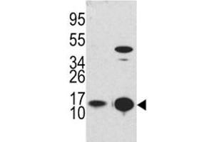 Western blot analysis of MAP1LC3B antibody and Y79 lysate and mouse brain tissue lysate
