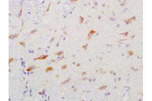 Formalin-fixed and paraffin embedded rat brain labeled with Anti-GGA2 Polyclonal Antibody, Unconjugated  at 1:200 followed by conjugation to the secondary antibody and DAB staining (GGA2 anticorps  (AA 161-260))