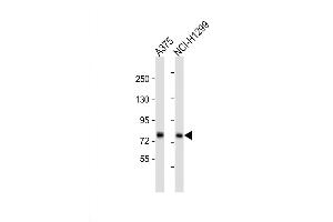 Western Blot at 1:1000 dilution Lane 1: A375 whole cell lysate Lane 2: NCI-H1299 whole cell lysate Lysates/proteins at 20 ug per lane.