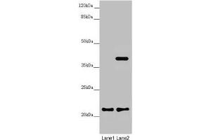 Western blot All lanes: DCTN6 antibody at 3.
