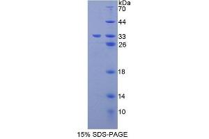 SDS-PAGE analysis of Mouse GLVR1 Protein. (SLC20A1 Protéine)