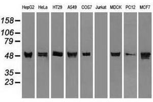 Image no. 3 for anti-Keratin 8 (KRT8) (AA 91-381) antibody (ABIN1491713)
