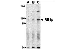 Western Blotting (WB) image for anti-Endoplasmic Reticulum To Nucleus Signaling 1 (ERN1) (N-Term) antibody (ABIN1031419) (ERN1 anticorps  (N-Term))