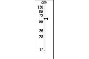 Western blot analysis of anti-CYP2J2 Antibody (Center) in CEM cell line lysates (35ug/lane). (CYP2J2 anticorps  (Middle Region))