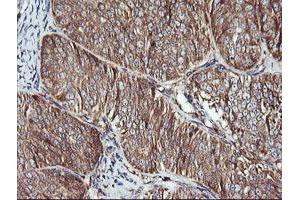 Immunohistochemistry (IHC) image for anti-Acetyl-CoA Acyltransferase 2 (ACAA2) antibody (ABIN1495723)