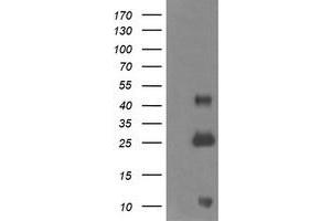 Western Blotting (WB) image for anti-Aldehyde Dehydrogenase 1 Family, Member A3 (ALDH1A3) (AA 1-100), (AA 413-512) antibody (ABIN1490536)