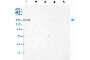 Western Blot analysis of recombinant protein Lane 1: Laminin-332, Lane 2: Laminin-421, Lane 3: Laminin-511, Lane 4: Laminin-121 and Lane 5: Laminin-221 with LAMA3 monoclonal antibody, clone CL3112 . (LAMA3 anticorps)