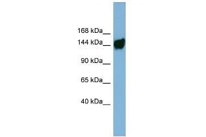 WB Suggested Anti-AASDH Antibody Titration: 0. (AASDH anticorps  (Middle Region))