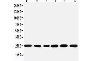 Anti-SNRPN antibody, Western blotting Lane 1: Rat kidney Tissue Lysate Lane 2: U87 Cell Lysate Lane 3: U87 Cell Lysate Lane 4: HELA Cell Lysate Lane 5: HMY Cell Lysate Lane 6: NEUR Cell Lysate (SNRPN anticorps  (N-Term))