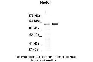 Lanes:   Lane 1: 50ug Mouse adipose lysate  Primary Antibody Dilution:   1:1000  Secondary Antibody:   Donkey anti-Rabbit-HRP  Secondary Antibody Dilution:   1:10000  Gene Name:   NEDD4  Submitted by:   Libin Liu, Boston University.