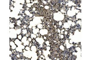 IHC analysis of CD11c/Itgax using anti-CD11c/Itgax antibody (ABIN7600041).