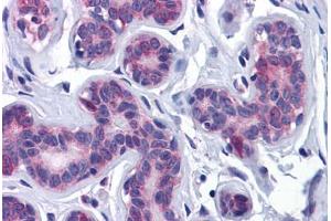 Human Breast: Formalin-Fixed, Paraffin-Embedded (FFPE) (AKT3 anticorps  (AA 119-136))