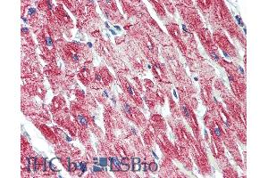 ABIN334386 (5µg/ml) staining of paraffin embedded Human Heart.