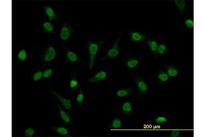 Immunofluorescence of monoclonal antibody to LEF1 on HeLa cell. (LEF1 anticorps  (AA 14-123))