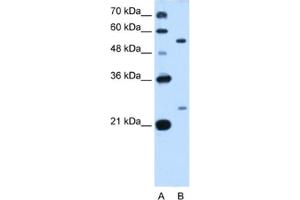 Western Blotting (WB) image for anti-LOC642486 (LOC642486) antibody (ABIN2462914) (LOC642486 anticorps)