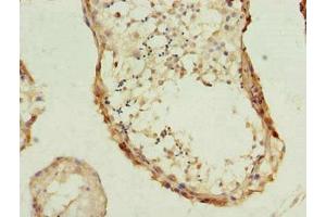 Immunohistochemistry of paraffin-embedded human testis tissue using ABIN7163042 at dilution of 1:100