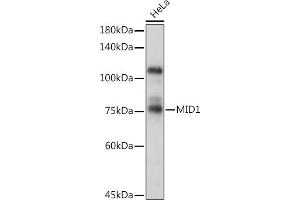 Western blot analysis of extracts of HeLa cells, using MID1 Rabbit pAb (ABIN6129304, ABIN6143835, ABIN6143836 and ABIN6223122) at 1:1000 dilution. (MID1 anticorps  (AA 478-667))
