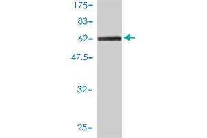 Western Blot detection against Immunogen (77. (CPVL anticorps  (AA 1-476))
