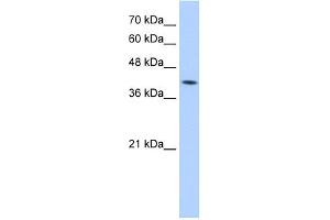 WB Suggested Anti-M6PR Antibody Titration:  5.