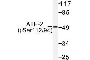 Image no. 1 for anti-Activating Transcription Factor 2 (ATF2) (pSer112), (pSer94) antibody (ABIN317963)