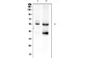 Western blot analysis of TGFBR1/Tgf Beta Receptor I using anti-TGFBR1/Tgf Beta Receptor I antibody (ABIN3043310).