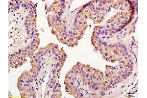 Formalin-fixed and paraffin embedded rat penile labeled with Anti-Claudin 5 Polyclonal Antibody, Unconjugated (ABIN673869) at 1:200 followed by conjugation to the secondary antibody and DAB staining