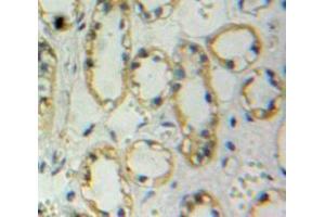 IHC-P analysis of Kidney tissue, with DAB staining. (Nephrin anticorps  (AA 39-106))