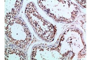 Immunohistochemical analysis of paraffin-embedded Human-testis, antibody was diluted at 1:100