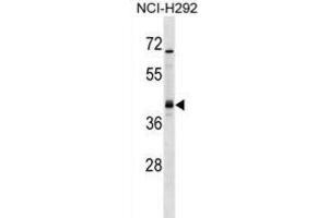 Western Blotting (WB) image for anti-Undifferentiated Embryonic Cell Transcription Factor 1 (UTF1) antibody (ABIN2999167) (UTF1 anticorps)
