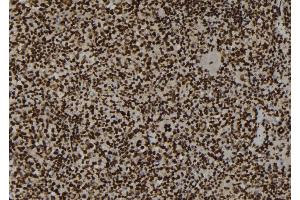 ABIN6267200 at 1/100 staining Mouse spleen tissue by IHC-P. (Topoisomerase II alpha anticorps  (pSer1469))