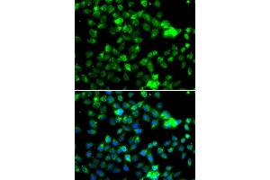 Immunofluorescence analysis of A549 cell using NAA20 antibody. (NAT5 anticorps)