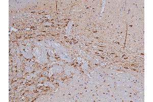 ABIN6267325 at 1/200 staining Rat brain tissue sections by IHC-P.
