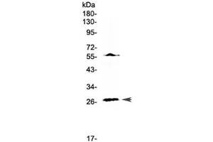 Western blot testing of human Jurkat cell lysate with IL17A antibody at 0. (Interleukin 17a anticorps)