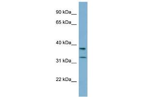 WB Suggested Anti-RALGPS2 Antibody Titration: 0. (RALGPS2 anticorps  (N-Term))